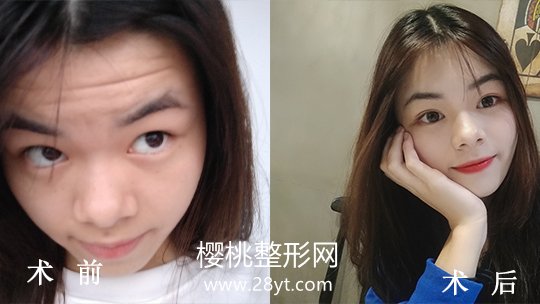 福州海峡美容医院口碑怎么样？附各项目价格表一览