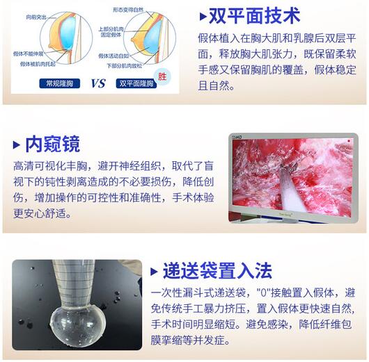 唐新辉 隆胸