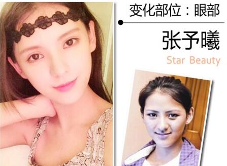 杨紫郑爽张予曦 告诉你90后女星整容都整了哪