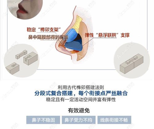 成都西区医院邓东伟8C骨雕鼻优势