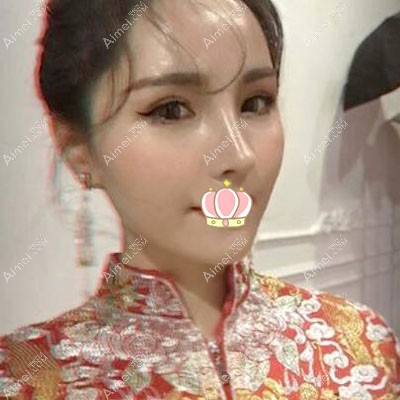 术后135天