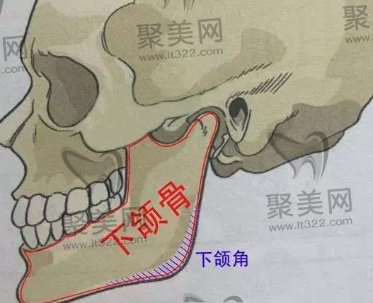 方脸做削骨手术费用贵不贵？