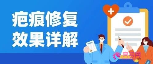 广州市中西医结合医院烧伤整形外科怎么样？医生信息与疤痕修复手术案例