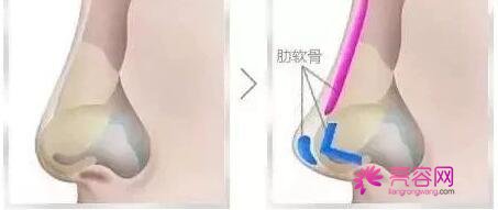 天津河东美莱医学于全双医生做隆鼻怎么样？医生口碑+双眼皮案例