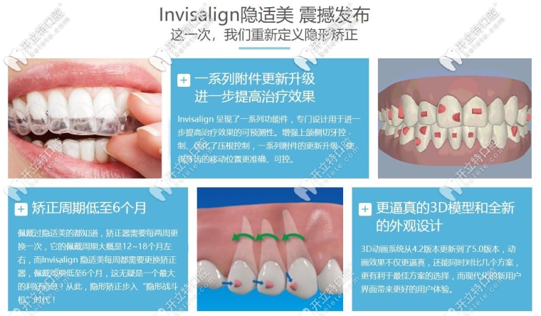 主编给您说贵阳做牙齿矫正一般多少钱