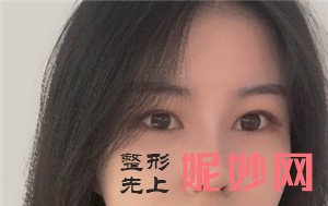 在北京新面孔医疗美容诊所找赵海成做肋软骨隆鼻，真人案例对比图展示