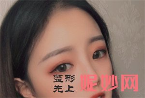 北京杏林美医疗美容诊所的于红敏做埋线双眼皮怎么样？真人案例分享