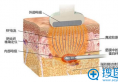 通过激光溶脂案例和价格表来告诉你激光溶脂多少钱？效果好吗？
