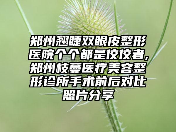 郑州翘睫双眼皮整形医院个个都是佼佼者,郑州枝蔓医疗美容整形诊所手术前后对比照片分享