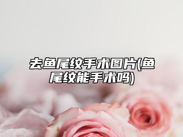 去鱼尾纹手术图片(鱼尾纹能手术吗)